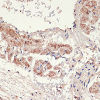 Immunohistochemistry of paraffin-embedded Rat lung using ADRA1A Polyclonal Antibody at dilution of 1:100 (40x lens) .