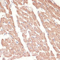 Immunohistochemistry of paraffin-embedded Rat heart using ADRA1A Polyclonal Antibody at dilution of 1:100 (40x lens) .