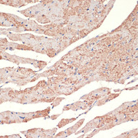 Immunohistochemistry of paraffin-embedded Mouse heart using ADRA1A Polyclonal Antibody at dilution of 1:100 (40x lens) .
