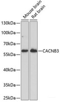 Western blot analysis of extracts of various cell lines using CACNB3 Polyclonal Antibody at dilution of 1:1000.