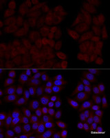 Immunofluorescence analysis of HeLa cells using CALM1 Polyclonal Antibody at dilution of 1:100 (40x lens) . Blue: DAPI for nuclear staining.