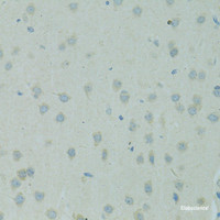 Immunohistochemistry of paraffin-embedded Rat brain using SMAD6 Polyclonal Antibody at dilution of 1:100 (40x lens) .