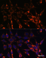Immunofluorescence analysis of NIH-3T3 cells using SMAD6 Polyclonal Antibody at dilution of 1:100. Blue: DAPI for nuclear staining.