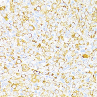 Immunohistochemistry of paraffin-embedded Rat ovary using ALDH6A1 Polyclonal Antibody at dilution of 1:100 (40x lens) .