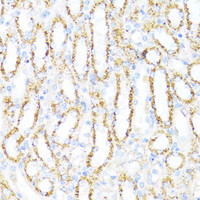 Immunohistochemistry of paraffin-embedded Mouse kidney using ALDH6A1 Polyclonal Antibody at dilution of 1:100 (40x lens) .