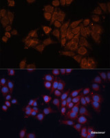 Immunofluorescence analysis of HeLa cells using ALDH6A1 Polyclonal Antibody at dilution of 1:100 (40x lens) . Blue: DAPI for nuclear staining.