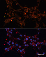 Immunofluorescence analysis of NIH-3T3 cells using ALDH6A1 Polyclonal Antibody at dilution of 1:100 (40x lens) . Blue: DAPI for nuclear staining.