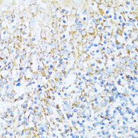 Immunohistochemistry of paraffin-embedded Human tonsil using NDUFA5 Polyclonal Antibody at dilution of 1:100 (40x lens) .