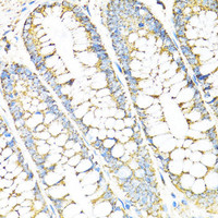 Immunohistochemistry of paraffin-embedded Human colon using SERPINE1 Polyclonal Antibody at dilution of 1:100 (40x lens) .