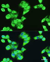 Immunofluorescence analysis of HeLa cells using SERPINE1 Polyclonal Antibody at dilution of 1:100. Blue: DAPI for nuclear staining.