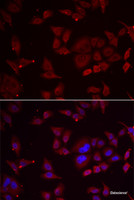 Immunofluorescence analysis of U2OS cells using PFKFB3 Polyclonal Antibody
