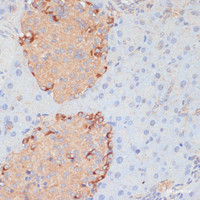 Immunohistochemistry of paraffin-embedded Mouse pancreas using PTPRN2 Polyclonal Antibody at dilution of 1:100 (40x lens) .