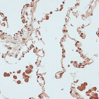 Immunohistochemistry of paraffin-embedded Human lung using RB1 Polyclonal Antibody at dilution of 1:100 (40x lens) .