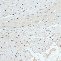 Immunohistochemistry of paraffin-embedded Mouse heart using RB1 Polyclonal Antibody at dilution of 1:100 (40x lens) .