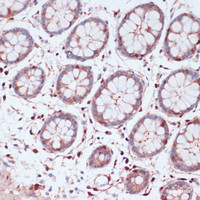 Immunohistochemistry of paraffin-embedded Human colon using S100A5 Polyclonal Antibody at dilution of 1:100 (40x lens) .