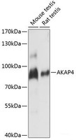Western blot analysis of extracts of various cell lines using AKAP4 Polyclonal Antibody at dilution of 1:1000.