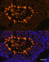 Immunofluorescence analysis of Rat testis using AKAP4 Polyclonal Antibody at dilution of 1:100. Blue: DAPI for nuclear staining.