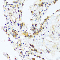 Immunohistochemistry of paraffin-embedded Human lung using BAG3 Polyclonal Antibody at dilution of 1:100 (40x lens) .