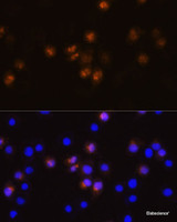 Immunofluorescence analysis of L929 cells using SWAP70 Polyclonal Antibody at dilution of 1:100. Blue: DAPI for nuclear staining.