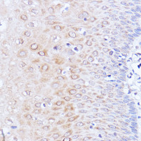 Immunohistochemistry of paraffin-embedded Human esophageal using Polyclonal AntibodyPC1 Polyclonal Antibody at dilution of 1:100 (40x lens) .