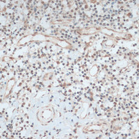 Immunohistochemistry of paraffin-embedded Human tonsil using ZNF416 Polyclonal Antibody at dilution of 1:100 (40x lens) .