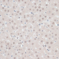 Immunohistochemistry of paraffin-embedded Rat liver using ZNF446 Polyclonal Antibody at dilution of 1:100 (40x lens) .