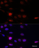 Immunofluorescence analysis of C6 cells using KLHL8 Polyclonal Antibody at dilution of 1:100. Blue: DAPI for nuclear staining.