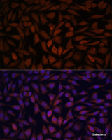 Immunofluorescence analysis of L929 cells using KLHL8 Polyclonal Antibody at dilution of 1:100. Blue: DAPI for nuclear staining.