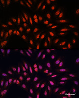 Immunofluorescence analysis of U-2 OS cells using KLHL8 Polyclonal Antibody at dilution of 1:100. Blue: DAPI for nuclear staining.