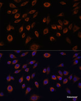 Immunofluorescence analysis of L929 cells using NTPCR Polyclonal Antibody at dilution of 1:100. Blue: DAPI for nuclear staining.