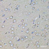 Immunohistochemistry of paraffin-embedded Rat brain using Osteopontin Polyclonal Antibody at dilution of 1:100 (40x lens) .