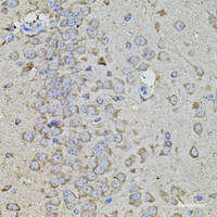 Immunohistochemistry of paraffin-embedded Mouse brain using Osteopontin Polyclonal Antibody at dilution of 1:100 (40x lens) .