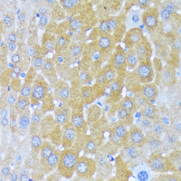 Immunohistochemistry of paraffin-embedded Mouse liver using AARS Polyclonal Antibody at dilution of 1:100 (40x lens) .