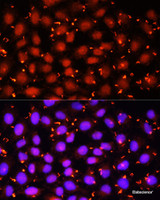 Immunofluorescence analysis of HeLa cells using ACAA1 Polyclonal Antibody at dilution of 1:100 (40x lens) . Blue: DAPI for nuclear staining.