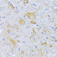 Immunohistochemistry of paraffin-embedded Mouse spinal cord using ACADSB Polyclonal Antibody at dilution of 1:100 (40x lens) .