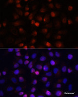 Immunofluorescence analysis of HeLa cells using ACP1 Polyclonal Antibody at dilution of 1:100 (40x lens) . Blue: DAPI for nuclear staining.