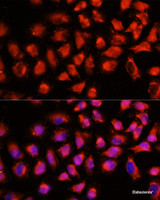 Immunofluorescence analysis of HeLa cells using ADAM8 Polyclonal Antibody at dilution of 1:100 (40x lens) . Blue: DAPI for nuclear staining.