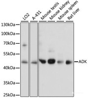 Western blot analysis of extracts of various cell lines using ADK Polyclonal Antibody at dilution of 1:1000.