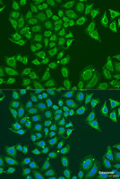 Immunofluorescence analysis of U2OS cells using ALDH1B1 Polyclonal Antibody at dilution of 1:100. Blue: DAPI for nuclear staining.