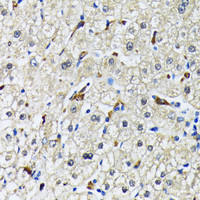 Immunohistochemistry of paraffin-embedded Human liver using CD68 Polyclonal Antibody at dilution of 1:200 (40x lens) .