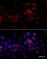 Immunofluorescence analysis of HeLa cells using CYP2J2 Polyclonal Antibody at dilution of 1:100 (40x lens) . Blue: DAPI for nuclear staining.