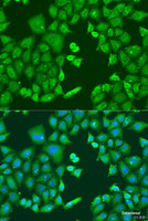 Immunofluorescence analysis of U2OS cells using CYP11B1 Polyclonal Antibody at dilution of 1:100. Blue: DAPI for nuclear staining.