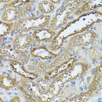 Immunohistochemistry of paraffin-embedded Rat kidney using DAPK3 Polyclonal Antibody at dilution of 1:100 (40x lens) .