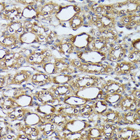 Immunohistochemistry of paraffin-embedded Mouse kidney using DAPK3 Polyclonal Antibody at dilution of 1:100 (40x lens) .