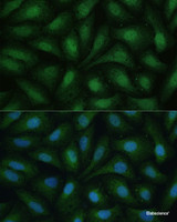 Immunofluorescence analysis of U-2 OS cells using DAPK3 Polyclonal Antibody at dilution of 1:100 (40x lens) . Blue: DAPI for nuclear staining.