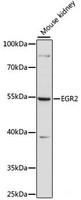 Western blot analysis of extracts of Mouse kidney using EGR2 Polyclonal Antibody at dilution of 1:1000.