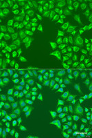 Immunofluorescence analysis of U2OS cells using LRP6 Polyclonal Antibody at dilution of 1:100. Blue: DAPI for nuclear staining.