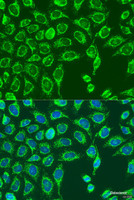 Immunofluorescence analysis of U2OS cells using MATN3 Polyclonal Antibody at dilution of 1:100. Blue: DAPI for nuclear staining.