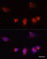 Immunofluorescence analysis of U-251MG cells using NPY Polyclonal Antibody at dilution of 1:100 (40x lens) . Blue: DAPI for nuclear staining.