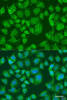 Immunofluorescence analysis of U2OS cells using PFKL Polyclonal Antibody at dilution of 1:100. Blue: DAPI for nuclear staining.